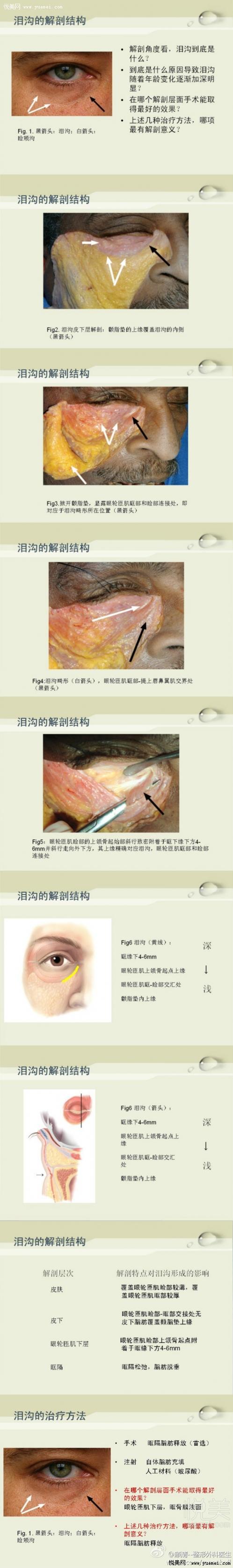 泪沟的解剖基础与治疗